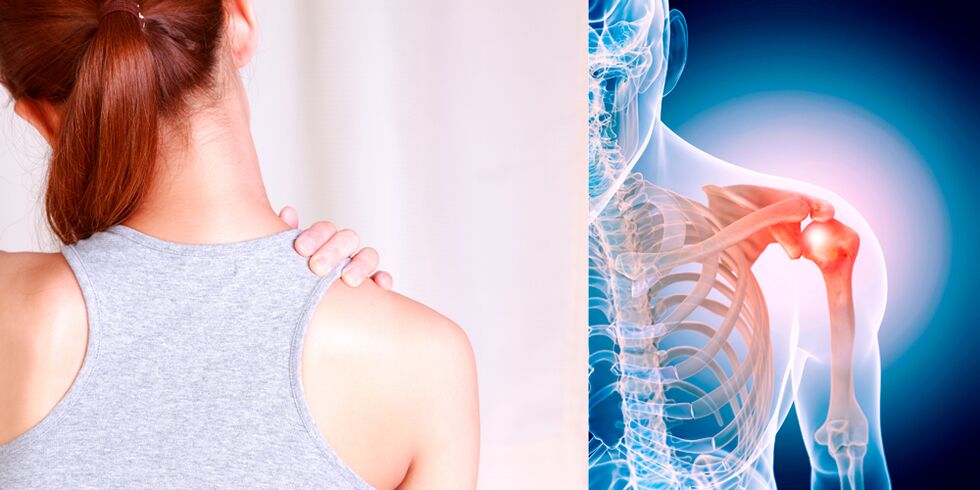 The development of osteoarthritis of the shoulders gradually leads to constant pain