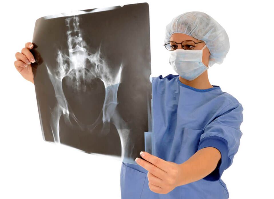 An x-ray of the hip joint will help the doctor determine the cause of the pain