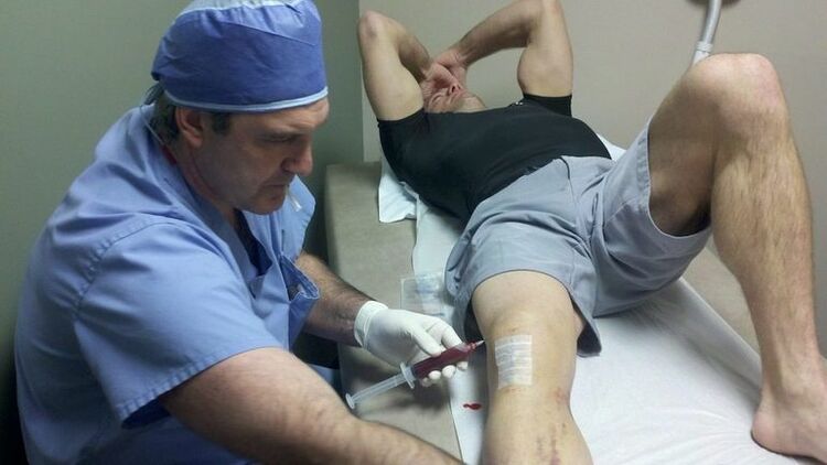 Treatment Arthrosis Knee joint