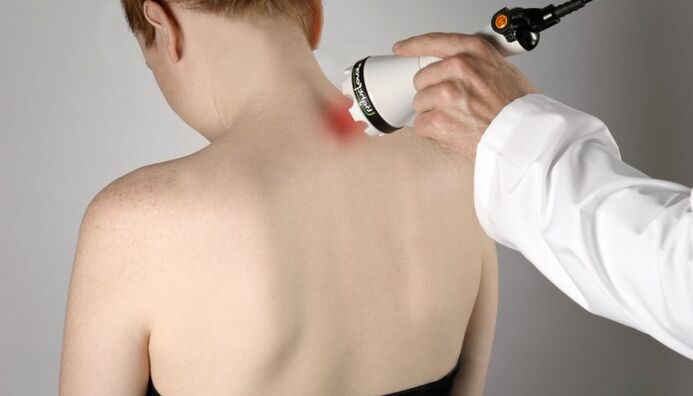 laser therapy of cervical osteochondrosis